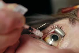 oog injectie